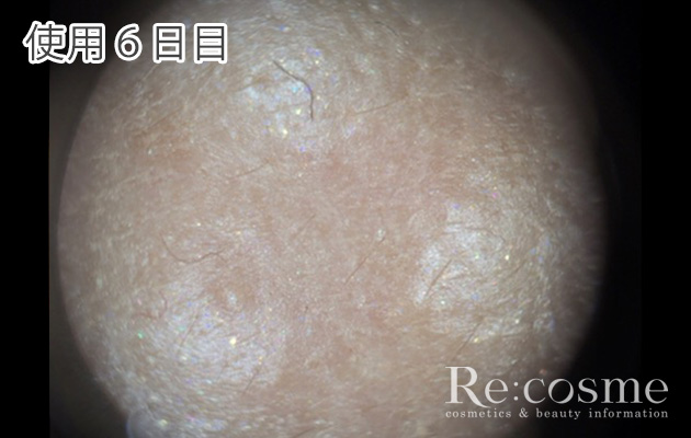 ニキビができる敏感肌がイプサザ タイムrアクアを検証 効果も解説